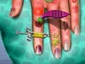 Игра Доктор по кожата на ръцете онлайн
