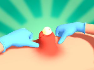 Игра Стискане на акне онлайн